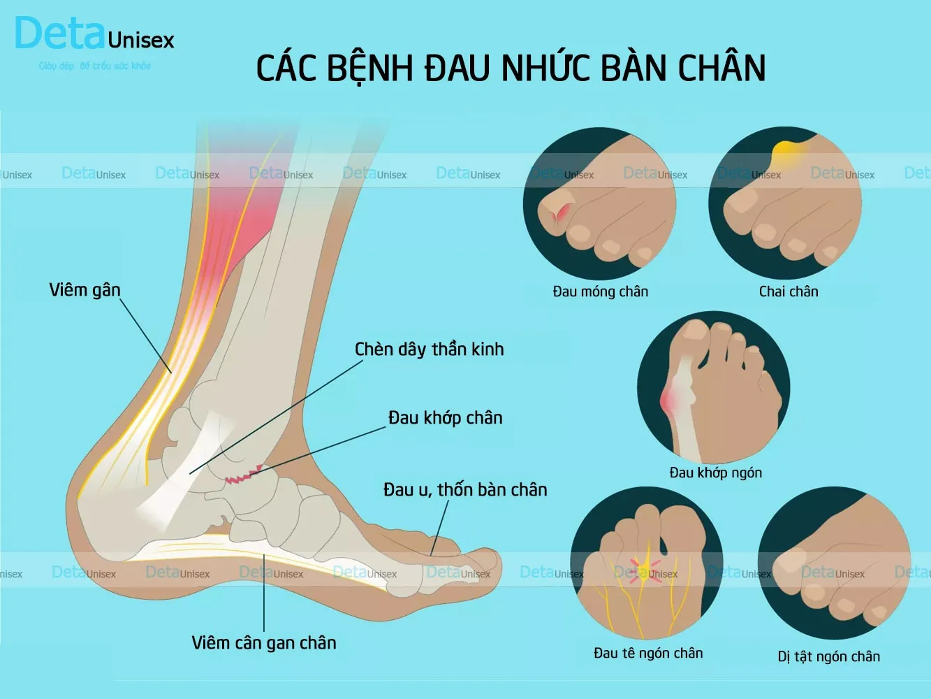 Giày thừa dép thiếu